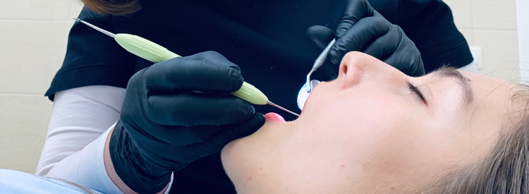 Лечение кариеса зубов в Пскове